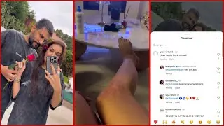 Evlilik yıldönümü| Dilan Polat’ın ayağı yandı #dilanpolat
