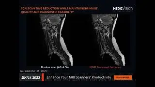 RSNA 2023 - what's new at the Medic Vision booth #4538