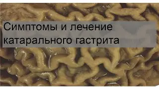 Симптомы и лечение катарального гастрита