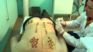 114.Процесс выполнения процедуры.Метод RANC.