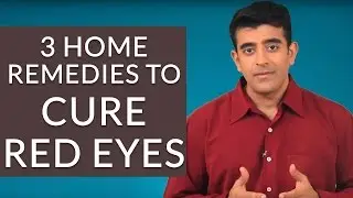 3 Effective Home Remedies To GET RID Of RED EYES