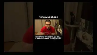 не оч смешно #мемы #рукибазуки #инвестиции #синтол #бизнес #базуки #пластическаяоперация