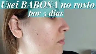 BABOSA NO ROSTO POR 5 DIAS | VEDA 6 | Elizabeth Cordeiro