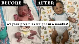 Helping premature babies gain weight | going viral on Instagram, baby bump, and size insecurities