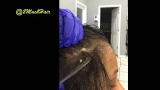 Part 4 Dermal Cleanse Scalp Scratching Flakes Removed #1