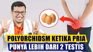 Polyorchidism Ketika pria punya lebih dari 2 testis - DOKTER SADDAM ISMAIL