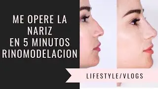 ME OPERE LA NARIZ - sin bisturí y en 5 minutos - Todo sobre mi Rinomodelación | Caro Paredes