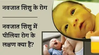 नवजत सिसु को पिलिया केसे ठीक करे #newborn #