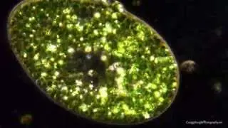 Paramecium bursaria. 40x-600x. Darkfield, ploarized light.