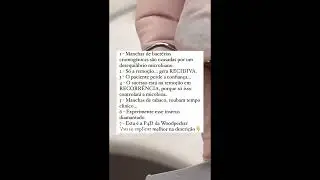 BACTÉRIAS CROMOGÊNICAS - remova com ultrassom e recorrência