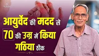 Rheumatoid Arthritis Treatment with the help of Ayurved