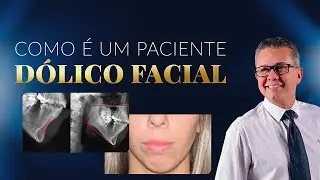 Como é um paciente Dólico Facial 🤔