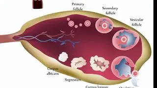 Ovarian Cysts