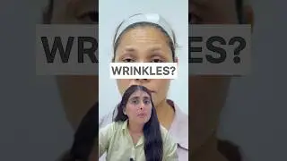 Wrinkles | How to get rid of forehead wrinkles| Botox| Botox treatment for face 
