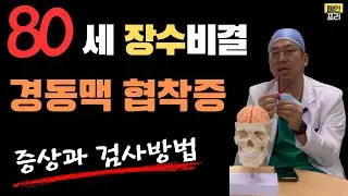경동맥 협착증, 증상과 검사, 1부 #신경외과 #뇌혈관질환 #경동맥 #스텐트 #내막절제술 #뇌경색 #뇌졸중 #뇌졸중전조증상