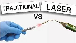 What's Best for Gum Disease Treatment? Surgery V.S. Laser