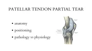 PATELLAR TENDON PARTIAL TEAR - musculoskeletal ultrasound examination