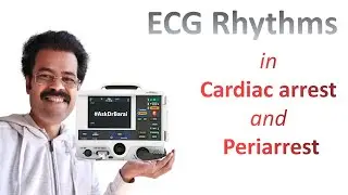 All the ECG Rhythms in Cardiac Arrest and Periarrest scenarios