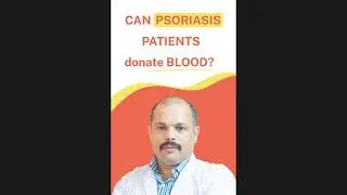 Can Psoriasis Patient Donate Blood? Know who can donate blood and who can not.