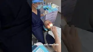 Вырвал зуб сам себе 🦷