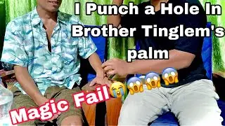 I punch a Hole in His Hand😱😱 @tinglemkonyak2560