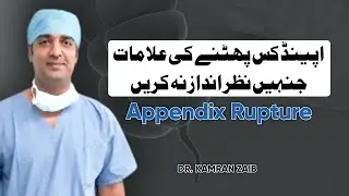 Appendix Rupture Symptoms | Dr. Kamran Zaib Explains Signs & Dangers