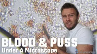 BLOOD & PUSS Under A Microscope