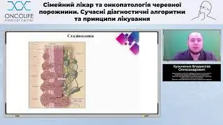 Діагностика раку стравоходу. Що досягнуто? До чого прагнемо? Кузьменко В.О. | Вебінар