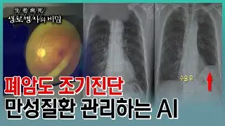 치아, 망막, 심장 등 AI 진단 솔루션으로 만성질환을 관리하는 최첨단 의료 현장속으로 (KBS 20230517 방송)