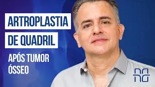 ARTROPLASTIA DE QUADRIL APÓS TUMOR ÓSSEO