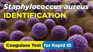 How to identify Staphylococcus aureus using the Coagulase Test - Slide and Tube Method