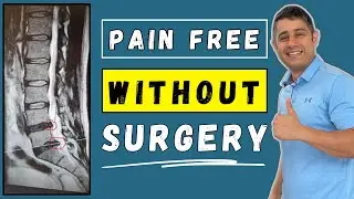 Annular Tear Recovery without surgery