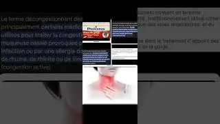 Pholcones