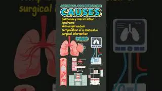 Arterial Gas Embolism Facts! 