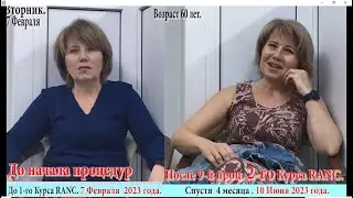 Лечение и омоложение Российским Методом РАНЦ.