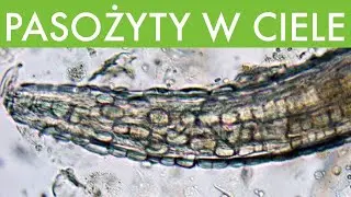 🐜 Robaki I Pasożyty W Ciele Nie Śpią, To Je Usunie Na Zawsze 🐛