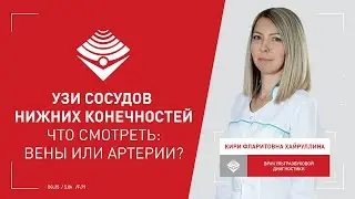 УЗИ сосудов ног