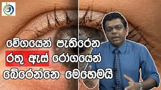 රතු ඇස භයානකයි! | Red Eye is Dangerous! | FOODbodyMIND