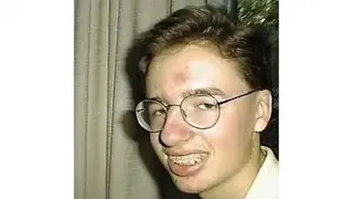Everyone teased him at school because of his appearance. 13 years have passed. Now he is unrecogniza