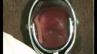 Obstetrics and Gynaecology : Clinical Examinations Collection - Pelvic Examination