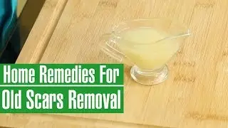 HOW TO REMOVE OLD SCARS FROM LEGS & FACE -  Natural Scar Removal