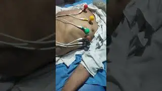 ECG || #ecg #ecginterpretation #shorts #ytshorts