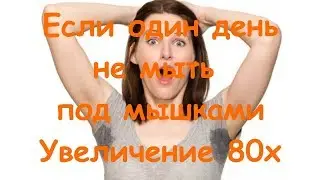 Если один день не мыть под мышками | Macro | Увеличение 80х