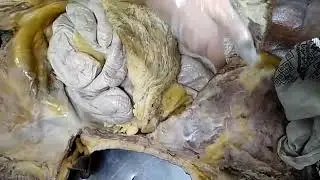 Dissection Nil Ratan Sircar Medical College and Hospital
