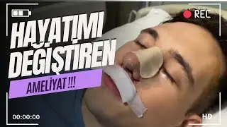 BURUN ESTETİĞİ SÜRECİM / BURUN ESTETİĞİN DE DİKKAT EDİLMESİ GEREKEN HUSUSLAR !!! VLOG#20