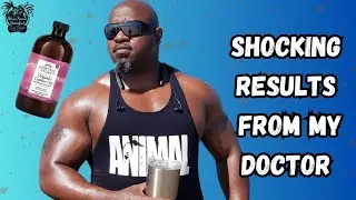 SHOCKING!! CASTOR OIL Results After 3 Months | My Dr Said Stop Taking This