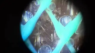 A bubble formation by vacuum infusion