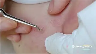 針清紀錄 香港美容店 SaMuu Beauty
