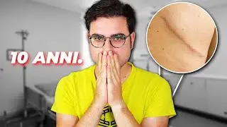 10 ANNI DOPO IL MIO TUMORE - Come sto?
