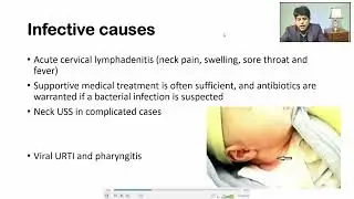 Clinical Approach to the Child with Torticollis